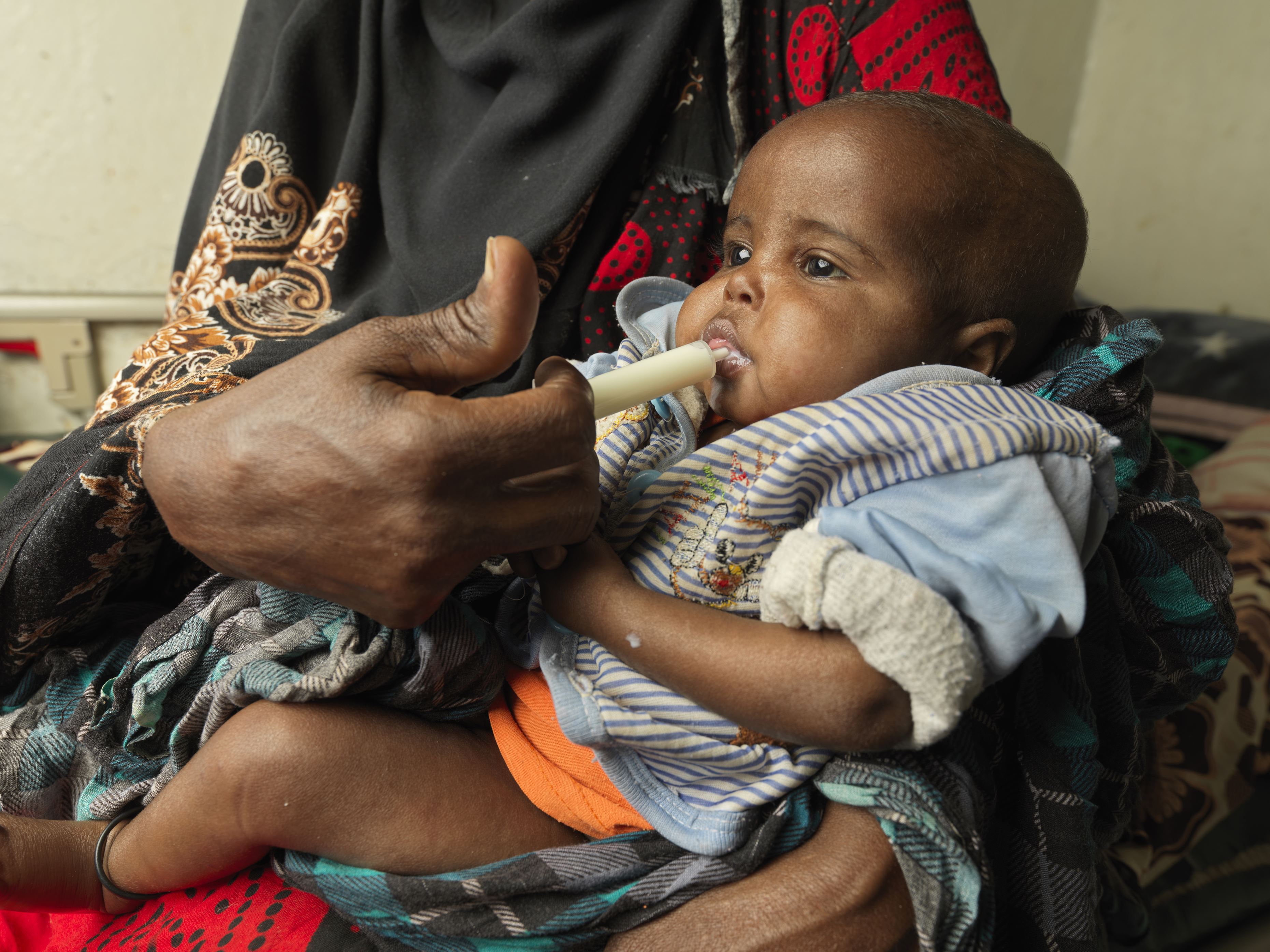 Bebé desnutrido de Somalilandia alimentado con una jeringa de leche